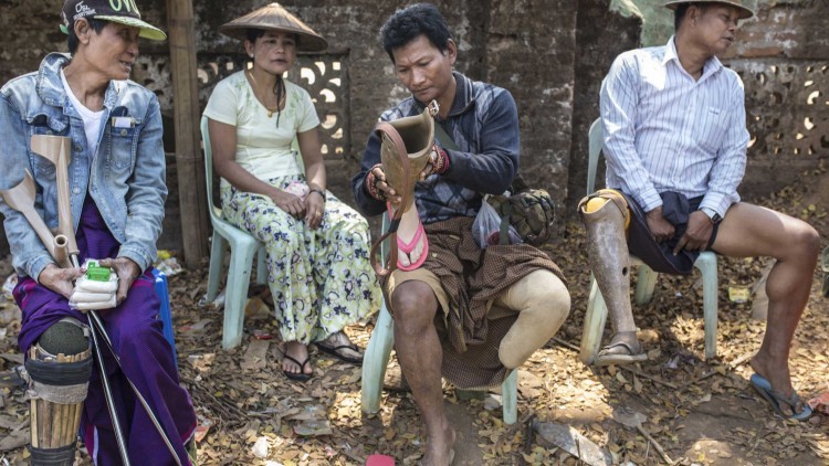 假肢服务就在身边 为缅甸患者带来希望