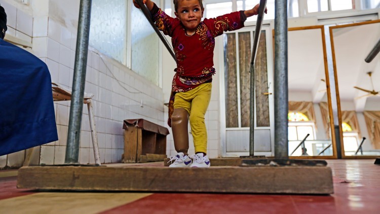 也门：三岁的哈亚特走出了康复中心