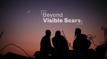 Beyond visible scars: Responding to mental health and psychosocial needs