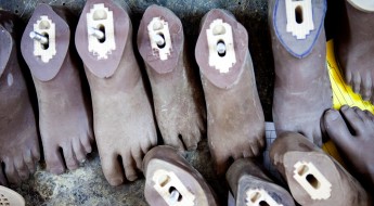 Sudão do Sul: perna protética transforma a deficiência em habilidade