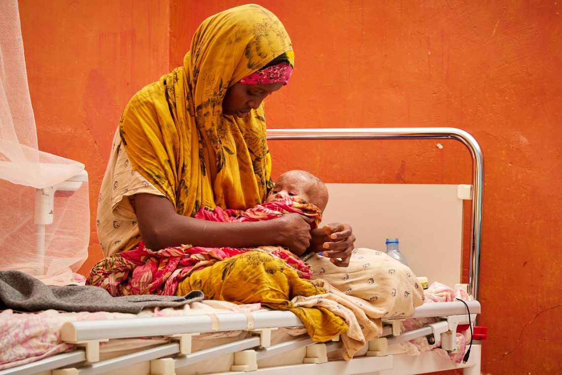 Aamino Mohamuds acht Monate alte Tochter wurde mit schwerer Unterernährung und einem Ödem eingeliefert. – IKRK/Abdikarim Mohamed