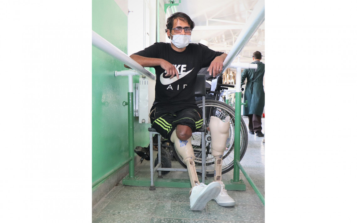 Mohammad Aajan, 28, having prosthetic legs fitted for the first time at the ICRC’s orthopaedic centre in Kabul. Photo: Mohammad Masoud Samimi / ICRC